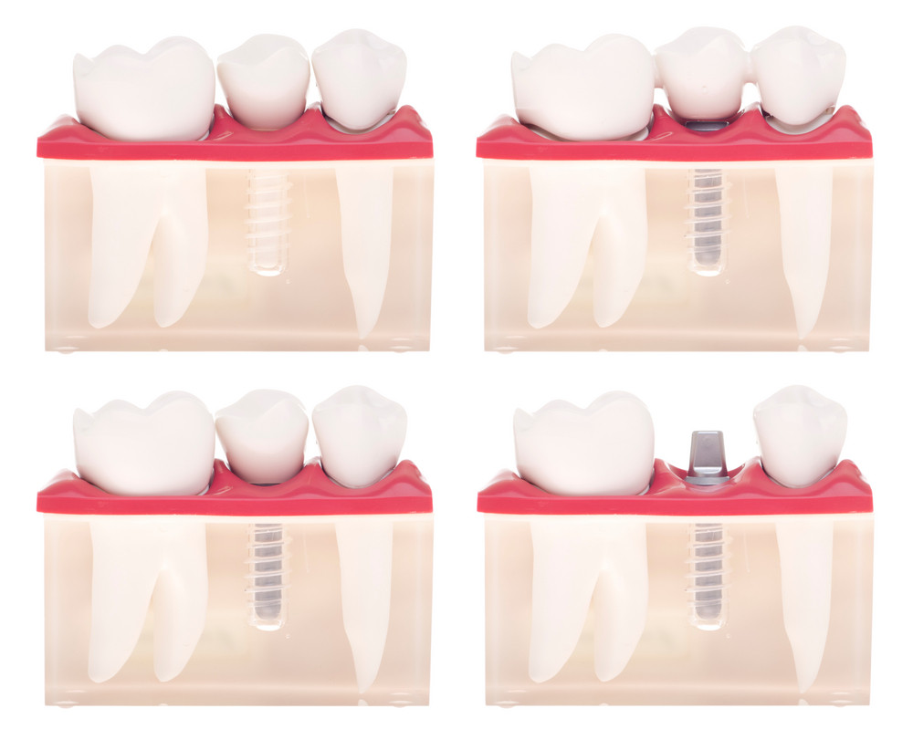 cosmetic dentist with good reviews