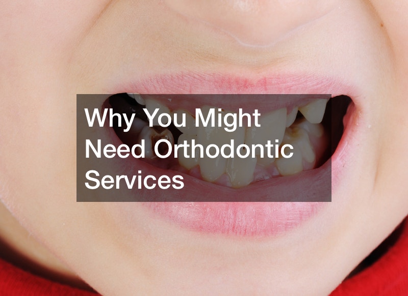 Why You Might Need Orthodontic Services
