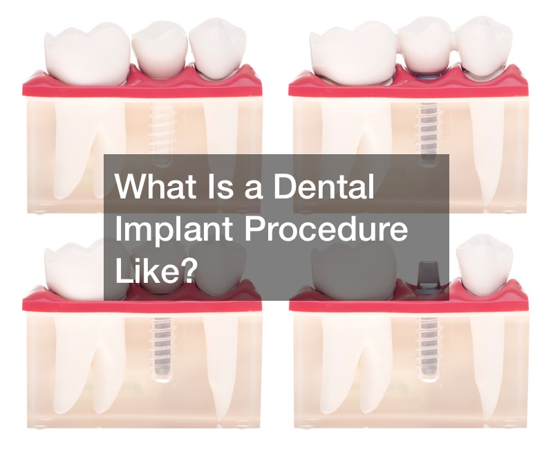 What Is a Dental Implant Procedure like?