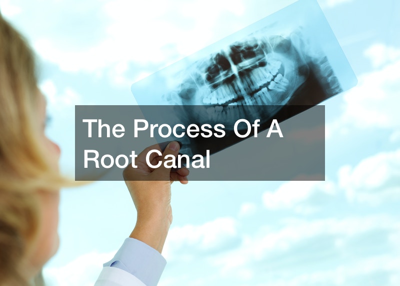 The Process of a Root Canal