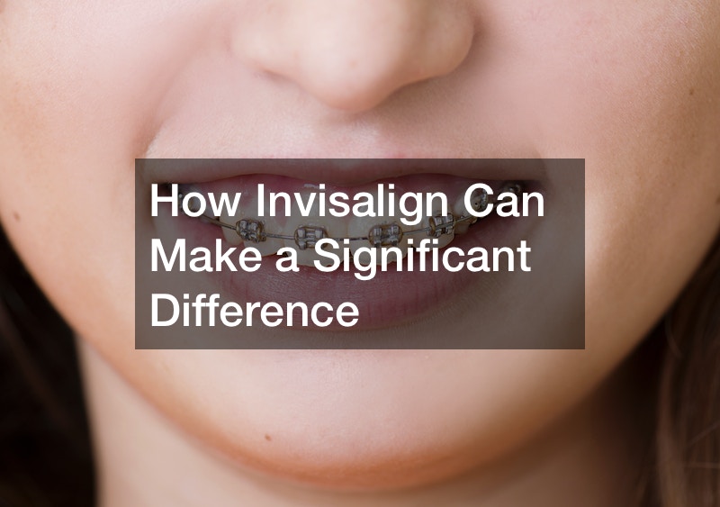 How Invisalign Can Make a Significant Difference
