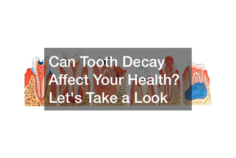 Can Tooth Decay Affect Your Health? Lets Take a Look