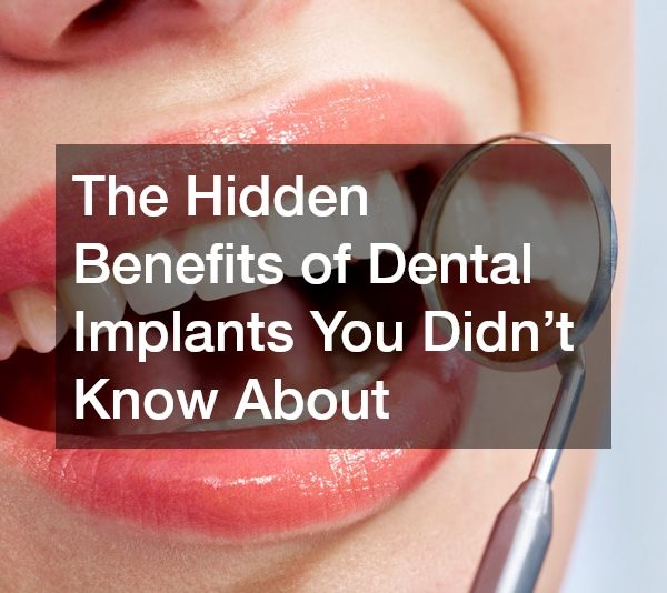 The Hidden Benefits of Dental Implants You Didnt Know About