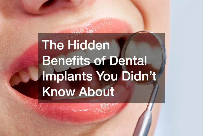 The Hidden Benefits of Dental Implants You Didnt Know About
