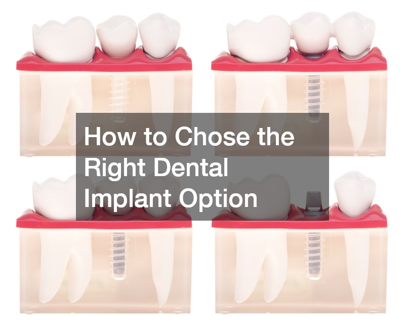 How to Chose the Right Dental Implant Option